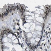 Anti-NSRP1 antibody produced in rabbit Prestige Antibodies® Powered by Atlas Antibodies, affinity isolated antibody, buffered aqueous glycerol solution