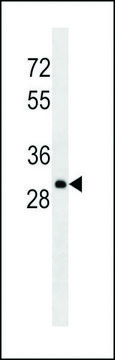 MONOCLONAL ANTI-LAMBDA LIGHT CHAIN antibody produced in mouse clone HP6054, IgG fraction of antiserum, buffered aqueous solution