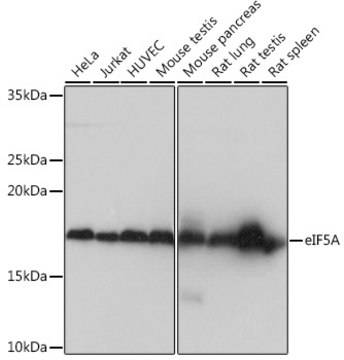 Anti-eIF5A Antibody, clone 3R10I7, Rabbit Monoclonal