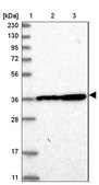 Anti-DNAJB14 antibody produced in rabbit Prestige Antibodies® Powered by Atlas Antibodies, affinity isolated antibody, buffered aqueous glycerol solution