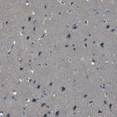 Anti-ADGRE5 antibody produced in rabbit Prestige Antibodies® Powered by Atlas Antibodies, affinity isolated antibody, buffered aqueous glycerol solution