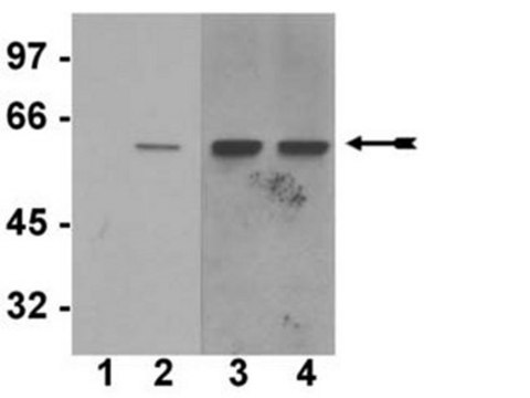 Anti-phospho-Akt1/PKB&#945; (Ser473) Antibody, clone SK703, rabbit monoclonal culture supernatant, clone SK703, Upstate&#174;