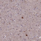 Anti-SPOCK2 antibody produced in rabbit Prestige Antibodies® Powered by Atlas Antibodies, affinity isolated antibody, buffered aqueous glycerol solution