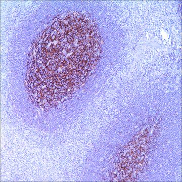 CD21 (EP3093) Rabbit Monoclonal Primary Antibody