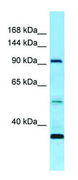 Anti-ROR1 (N-terminal) antibody produced in rabbit affinity isolated antibody