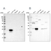 Anti-BAG2 antibody produced in rabbit Prestige Antibodies® Powered by Atlas Antibodies, affinity isolated antibody, buffered aqueous glycerol solution