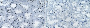 Anti-MBD3 Antibody, clone 1K19 ZooMAb® Rabbit Monoclonal recombinant, expressed in HEK 293 cells