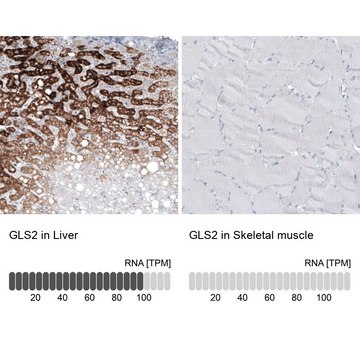 Monoclonal Anti-GLS2 antibody produced in mouse Prestige Antibodies&#174; Powered by Atlas Antibodies, clone CL7721, purified immunoglobulin, buffered aqueous glycerol solution