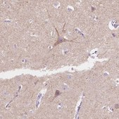 Anti-TMEM130 antibody produced in rabbit Prestige Antibodies® Powered by Atlas Antibodies, affinity isolated antibody, buffered aqueous glycerol solution