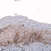 Anti-GPC6 antibody produced in rabbit Prestige Antibodies® Powered by Atlas Antibodies, affinity isolated antibody, buffered aqueous glycerol solution