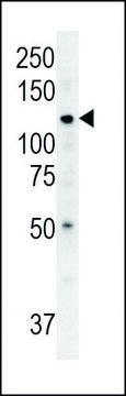 ANTI-ATP13A3 (N-TERM) antibody produced in rabbit IgG fraction of antiserum, buffered aqueous solution