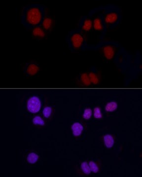 Anti-Brachyury Antibody, clone 2F8Y9, Rabbit Monoclonal