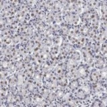 Anti-TOR1AIP1 antibody produced in rabbit Prestige Antibodies&#174; Powered by Atlas Antibodies, affinity isolated antibody, buffered aqueous glycerol solution