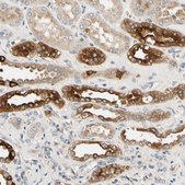 Anti-USP46 antibody produced in rabbit Prestige Antibodies® Powered by Atlas Antibodies, affinity isolated antibody, buffered aqueous glycerol solution