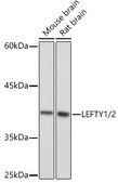 Anti-LEFTY1/2 antibody produced in rabbit