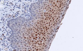 Anti-MRP-8/14 Antibody, clone AHN-17 ZooMAb® Mouse Monoclonal recombinant, expressed in HEK 293 cells