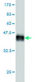 Monoclonal Anti-LAMA2 antibody produced in mouse clone 2D4, purified immunoglobulin, buffered aqueous solution