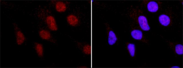 Monoclonal Anti-Histone H3 (C-terminal) antibody produced in mouse clone H6.10, purified from hybridoma cell culture