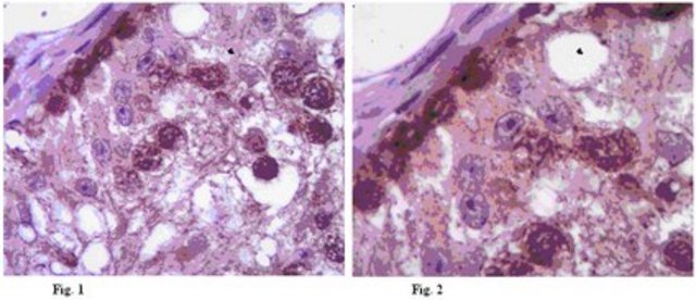 Anti-DAZ Antibody from rabbit, purified by affinity chromatography