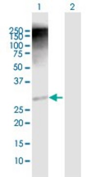 Anti-RAD1 antibody produced in rabbit purified immunoglobulin, buffered aqueous solution