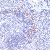 Anti-Phospho-IRE1alpha-S724 antibody produced in rabbit
