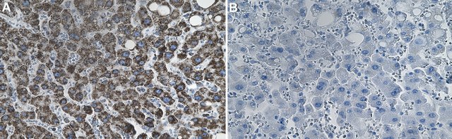 Anti-ATP Synthase &#946; Antibody, clone 1E6 ZooMAb&#174; Rabbit Monoclonal recombinant, expressed in HEK 293 cells