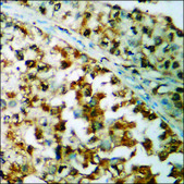 Anti-phospho-IRS-1 (pSer636) antibody produced in rabbit affinity isolated antibody