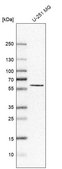 抗-CEP55 兔抗 Prestige Antibodies® Powered by Atlas Antibodies, affinity isolated antibody, buffered aqueous glycerol solution