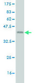 Monoclonal Anti-ETV1 antibody produced in mouse clone 4C12, purified immunoglobulin, buffered aqueous solution