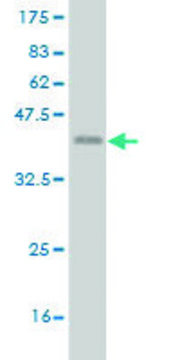 Monoclonal Anti-ETV1 antibody produced in mouse clone 4C12, purified immunoglobulin, buffered aqueous solution