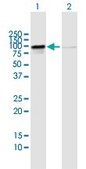 Anti-RIOK1 antibody produced in mouse purified immunoglobulin, buffered aqueous solution