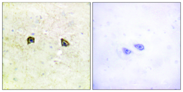 Anti-EPHB1 antibody produced in rabbit affinity isolated antibody