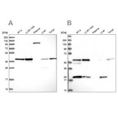 Anti-SAE1 antibody produced in rabbit Prestige Antibodies® Powered by Atlas Antibodies, affinity isolated antibody, buffered aqueous glycerol solution