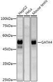 Anti-GATA4 Antibody, clone 1M2E4, Rabbit Monoclonal