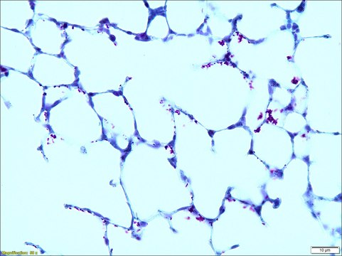 Carbol-Fuchsin Solution