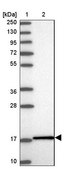 Anti-UBE2L3 antibody produced in rabbit Prestige Antibodies® Powered by Atlas Antibodies, affinity isolated antibody, buffered aqueous glycerol solution