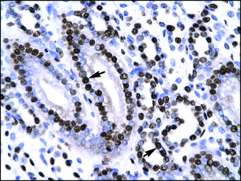 Anti-NR2F6 (AB1) antibody produced in rabbit affinity isolated antibody