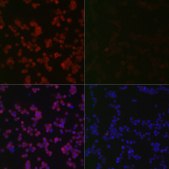 Anti-Phospho-Erk1-T202/Y204 + Erk2-T185/Y187 antibody produced in rabbit