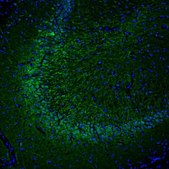 Anti-DPP6 antibody produced in rabbit Prestige Antibodies® Powered by Atlas Antibodies, affinity isolated antibody, buffered aqueous glycerol solution