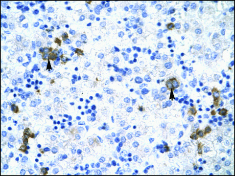 Anti-TRIM17 (AB1) antibody produced in rabbit affinity isolated antibody