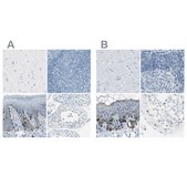 Anti-DCT antibody produced in rabbit Prestige Antibodies® Powered by Atlas Antibodies, affinity isolated antibody, buffered aqueous glycerol solution