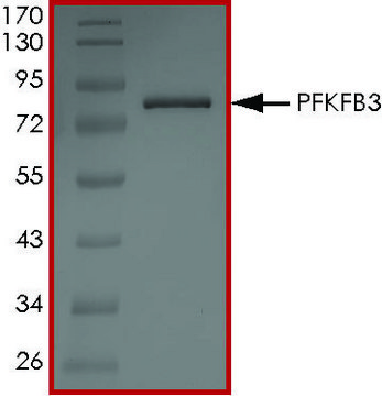 PFKFB3 Protein recombinant