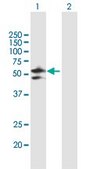 Anti-DDX47 antibody produced in mouse purified immunoglobulin, buffered aqueous solution