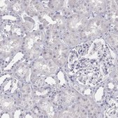 Anti-ANKRD65 antibody produced in rabbit Prestige Antibodies® Powered by Atlas Antibodies, affinity isolated antibody, buffered aqueous glycerol solution