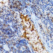 Anti-TACC3 antibody produced in rabbit