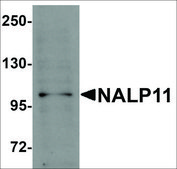 Anti-NALP11 antibody produced in rabbit affinity isolated antibody, buffered aqueous solution