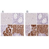 Anti-FTCD antibody produced in rabbit Prestige Antibodies® Powered by Atlas Antibodies, affinity isolated antibody, buffered aqueous glycerol solution