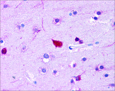 Anti-FABP4 antibody produced in rabbit affinity isolated antibody