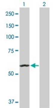 Anti-ACO2 antibody produced in rabbit purified immunoglobulin, buffered aqueous solution