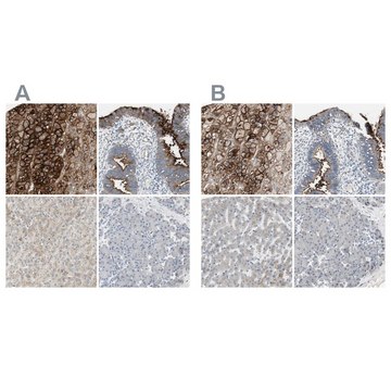 Anti-ALPL antibody produced in rabbit Ab2, Prestige Antibodies&#174; Powered by Atlas Antibodies, affinity isolated antibody, buffered aqueous glycerol solution